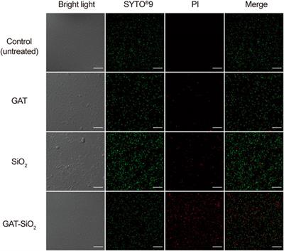 Design of a Controlled-Release Delivery Composite of Antibacterial Agent Gatifloxacin by Spherical Silica Nanocarrier